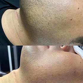 首页（images 11）