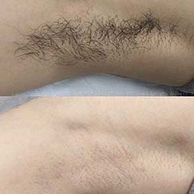 首页（images 14）